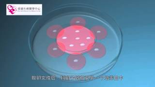 ivf, ivf过程, ivf 抽卵, 试管婴儿, 试管婴儿流程, 人工受孕 - ivf hong kong