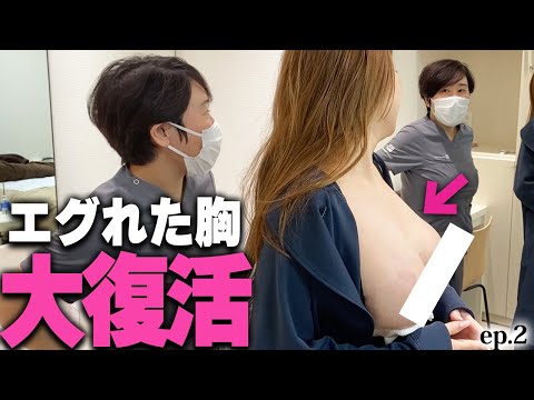 「そびえ立ってる！」授乳で萎んだ30代若ママのバストが脂肪豊胸で全盛期超え！ ep2｜美ボディラインch#226