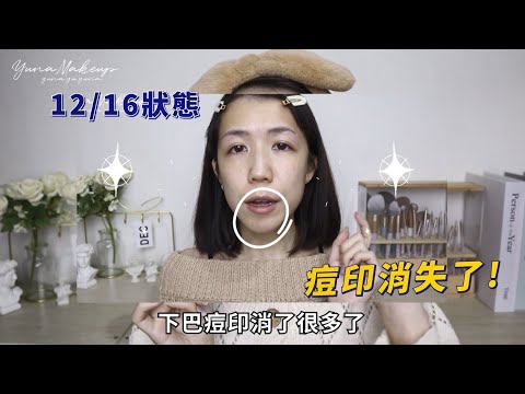 再次推薦！Dr.May 這系列無水超濃精華真的太讓人驚艷啦！這次嘗試用疊擦方式挑戰更高等級的膚況！feat.Yuna悠那