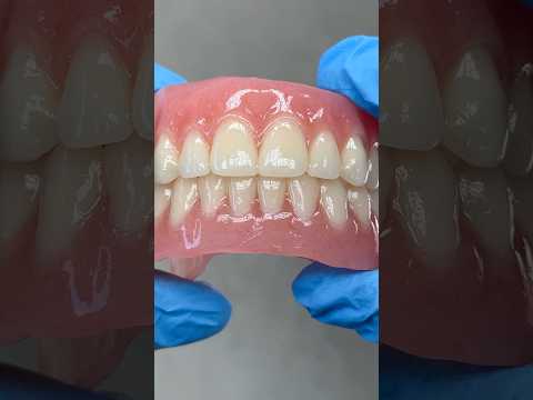 Beautiful Dentures #lsk121shorts #dentist #teeth