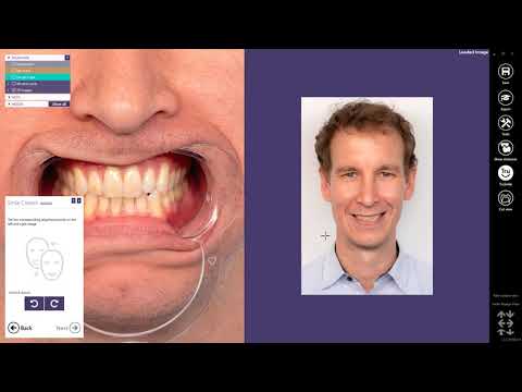 exocad Quick Guide Get the most out of your Smile Creator Module!