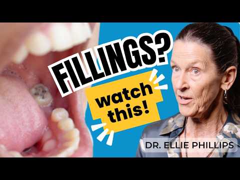 The Shocking Truth of Dental Fillings