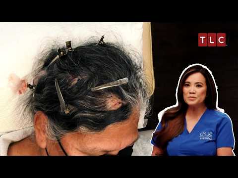 The Case That Could Break Dr Lee’s Heart! | Dr Pimple Popper TLC