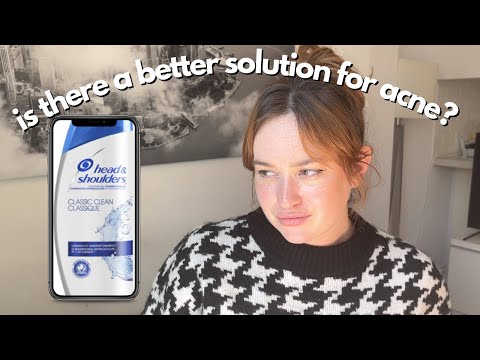 Can Head & Shoulders Shampoo Treat Acne? | A Biochemist Perspective