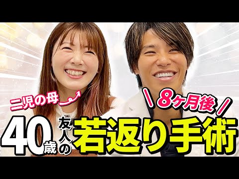 【40代女性のたるみ治療】育児疲れ顔にサヨナラ！二児の母が30代の自分を取り戻す若返り術【ダウンタイムレポ1ヶ月分あり】