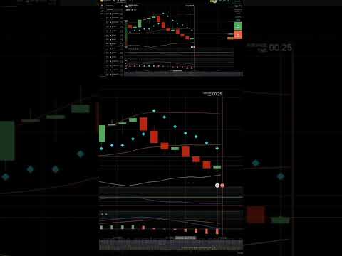 +$258 iq option trading 09 feb 2025 #trading #trader #investing #optionstrade #optionstrading