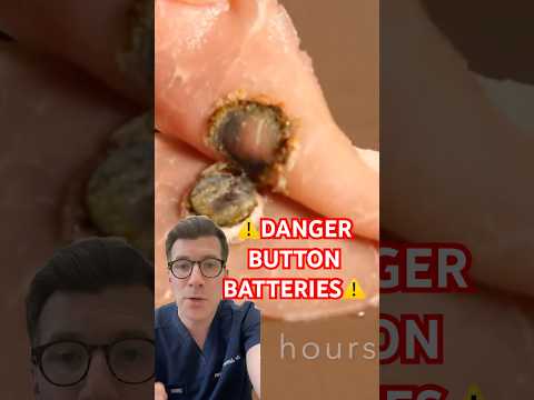 DANGERS OF SWALLOWING A BUTTON BATTERY #shorts