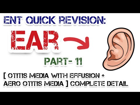 (OTITIS MEDIA with Effusion + AERO Otitis Media) Complete Detail | Dr Deen Lectures