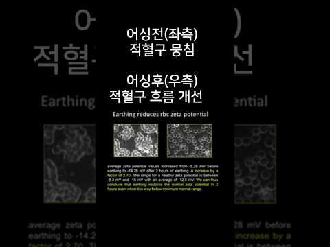 혈액순환개선 결과 어싱효과 연구-미국국립의학도서관 자료