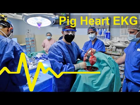 The Surprise EKG Readings from the World's First Pig Heart Transplant