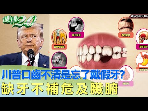 川普口齒不清是忘了戴假牙？缺牙不補危及臟腑 健康2.0 @tvbshealth20