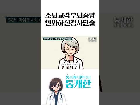 뇌종양으로 인한 삼차신경통