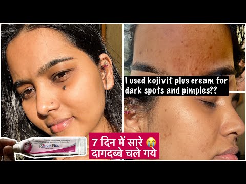 How I treat my dark spots & Acne mark | My experience | kojivit plus for dark spots & Pigmentation🫧