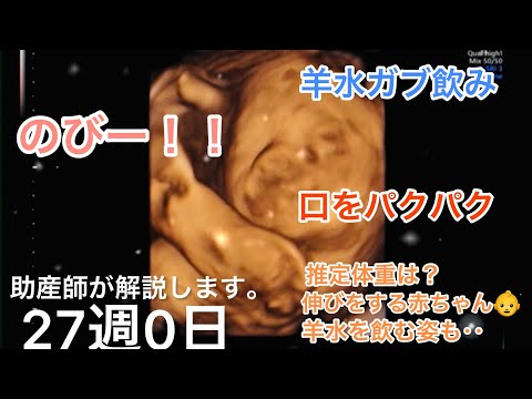 【妊娠27週】助産師がエコーを解説してみた‼️妊娠28週、妊娠29週、妊娠26週妊娠8ヶ月妊婦健診🤰