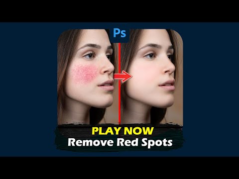 Remove red spots on the skin in Photoshop #shorts #photoshop