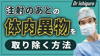 体の中の異物を取り除くメカニズム