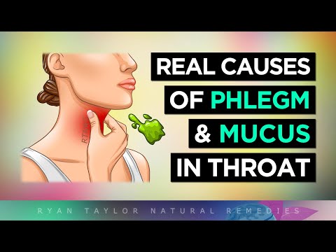 The Real Causes of Constant PHLEGM & MUCUS (In Your Throat)