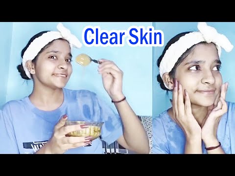 How to Remove Dark Patches on Face | How to Remove Dark Spots Caused by Pimples or Hyperpigmentation