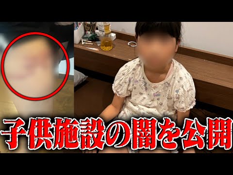 子供施設の闇をすべて公開…預けた娘が職員のミスで大火傷…監視カメラの映像公開拒否、泣き寝入りしかない？被害者家族に会いに行く