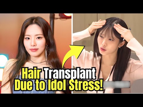 fromis_9's Park Jiwon Opens Up About Hair Loss & Transplant Due to Idol Stress!