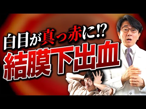 白目に出血！コレって大丈夫？【眼科医解説】