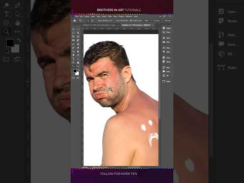 fix sunburns in photoshop