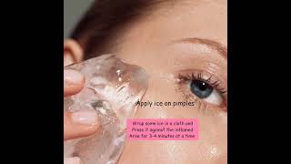 How to get rigid of pimple naturally? #ytshorts #getrigidofpimple #glowingskin #pimplefreeface