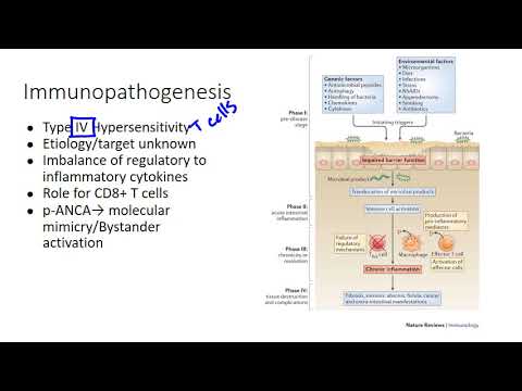 Immunopathogenesis of Ulcerative Colitis