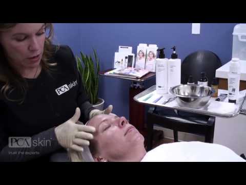 Dermaplaning & PCA SKIN Professional Treatments