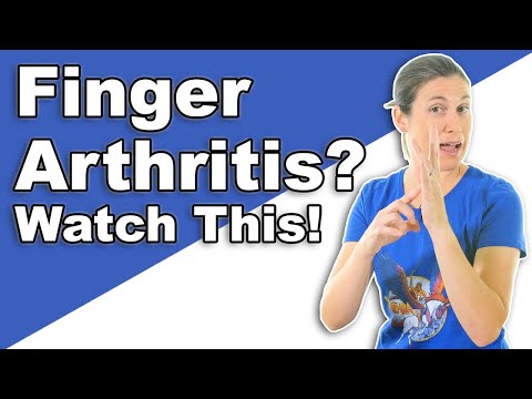 Finger Arthritis Relief: Effective Tips to Ease Pain!