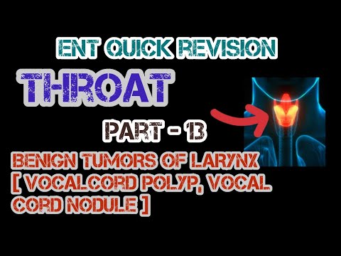 Understanding Vocal Cord Polyps & Nodules | Benign Tumors of the Larynx | Dr Deen Lectures