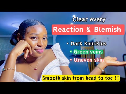 How to repair your skin & get a smooth glowing skin |clear stretch marks, dark knuckles, green veins