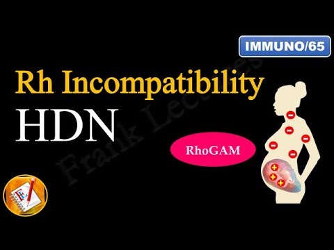 Rh Incompatibility: Hemolytic Disease of the Newborn (Erythroblastosis fetalis) (FL-Immuno/65)