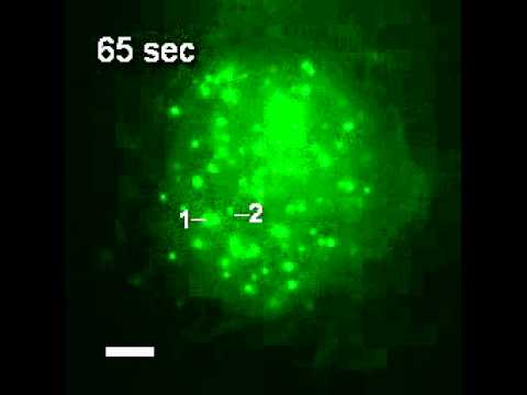 Live imaging of telomeres in RPE cells using CRISPR