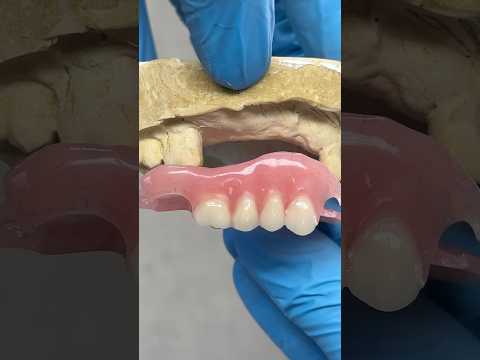 Filling in the gap with an AcryGrip Partial #lsk121shorts #dentist #teeth