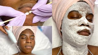 Deep Cleansing Oxygen Facial + Close Up Extractions