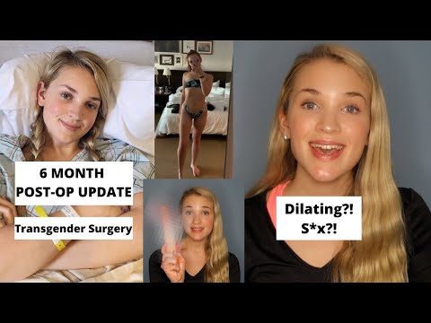 6 MONTH POST-OP GENDER REASSIGNMENT SURGERY UPDATE! | IN DEPTH | EMILY TRESSA |