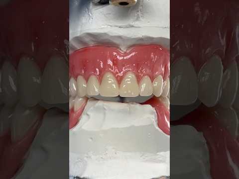 Wax Prototype #lsk121shorts #dentist #teeth