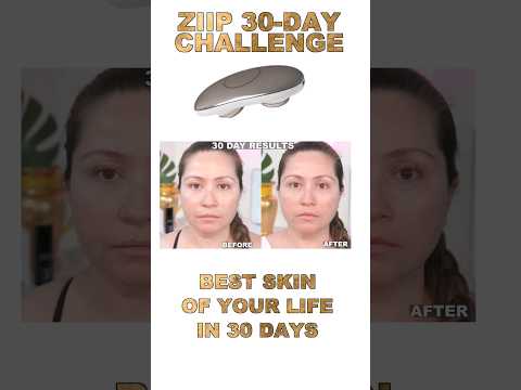 ⚡ZIIP HALO 30-DAY TRANSFORMATION: Unlock your best skin #ziiphalo #microcurrent #beforeandafter