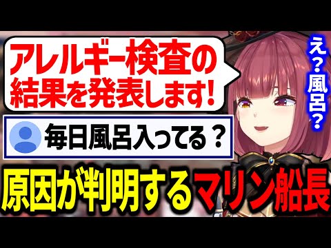 【悲報】風呂に入らない事が原因でアレルギーになっていた可能性が出てしまうマリン船長【宝鐘マリン/ホロライブ切り抜き】