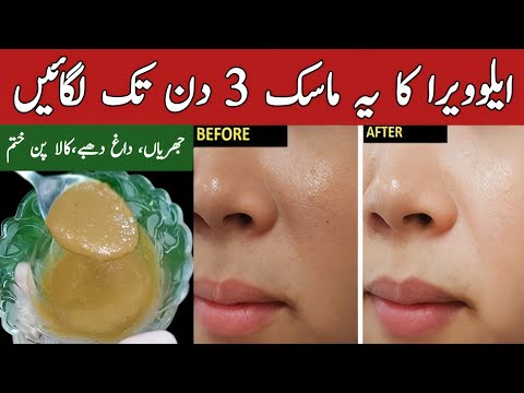 3 Days Challenge For Glowing & Brightening Skin | Homemade Face Pack For Skin Whitening | Face Mask