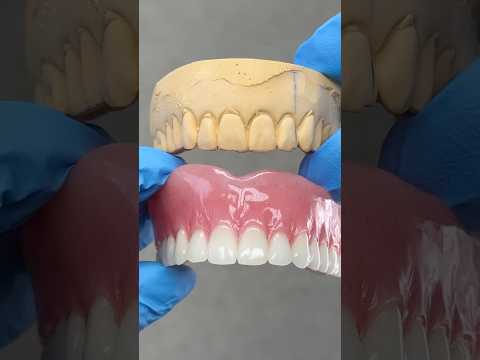 Before and After Process Denture #lsk121shorts #dentist #teeth