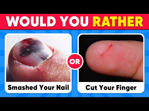 Would You Rather...? 100 HARDEST Choices Ever!🔥😱😨 EXTREME Edition