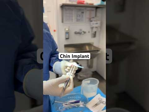 Have You Ever Seen a Chin Implant Up Close? 👀✨#chinimplant #facialimplants #chinaugmentation