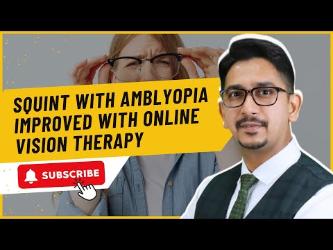 Squint with amblyopia improved with online vision therapy I एम्ब्लियोपिया के साथ भेंगापन में सुधार