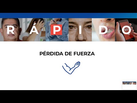 RÁPIDO - Cuando Es Un Derrame Cerebral, Cada Segundo Cuenta