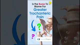 Greater Trochanteric Pain #anatomy #physiotherapy #physicaltherapy #gtps #hippain