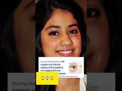 Janhvi Kapoor's Eyes plastic surgery #janvikapoor #youtube #shorts