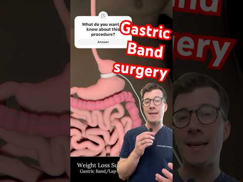 Doctor explains gastric band surgery for weight loss #shorts