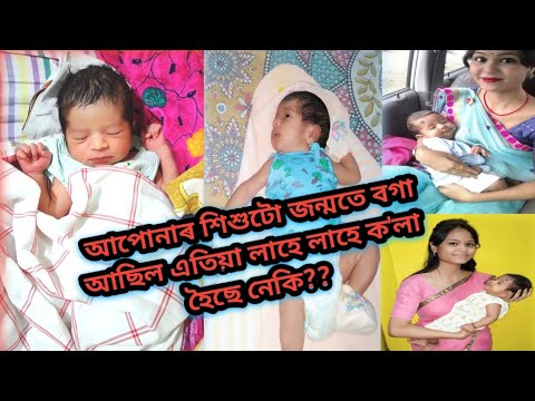 আপোনাৰ শিশুটিয়ে ৰং সলাইছে নেকি!!জন্মতে বগা হোৱা শিশুৰ ৰং হঠাৎ ক'লা কিয় হয়||